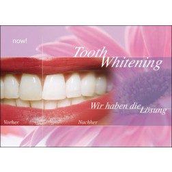 Tooth Whitening