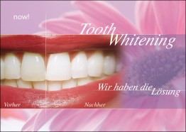 Tooth Whitening